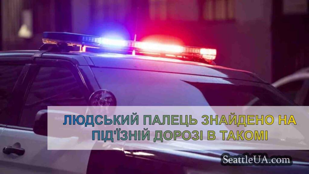 Людський палець знайдено на під'їзній