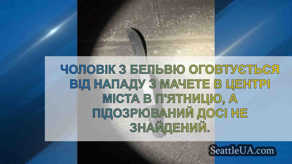 Розшукується підозрюваний у нападі на