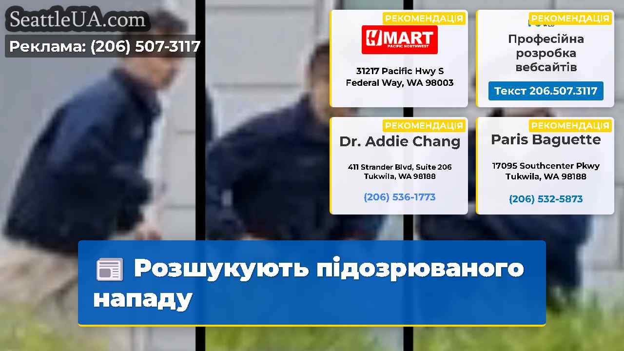 Розшукують підозрюваного нападу