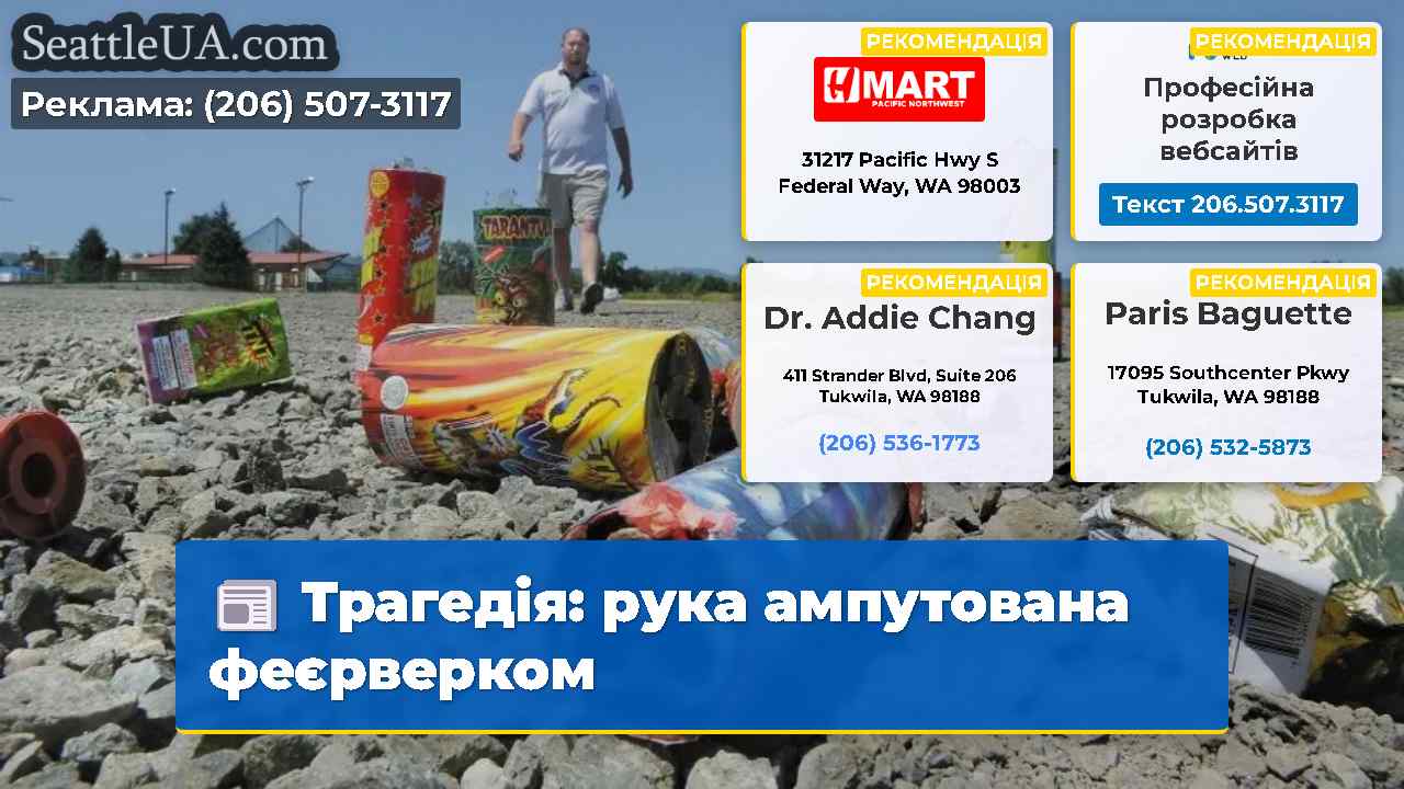 Трагедія: рука ампутована феєрверком