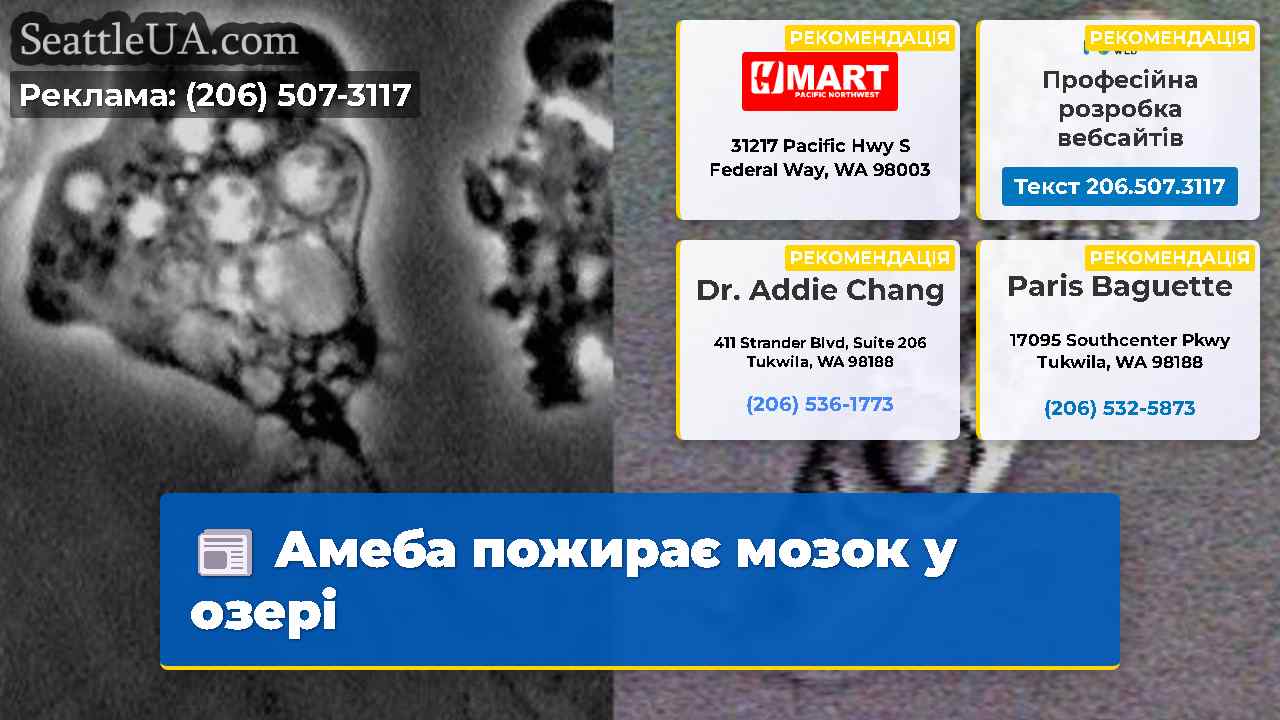 Амеба пожирає мозок у озері