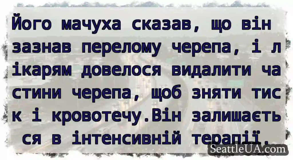 Його мачуха сказав, що він зазнав перелому