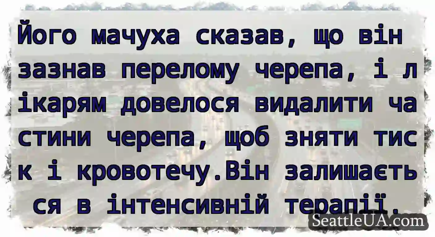 Його мачуха сказав, що він зазнав перелому