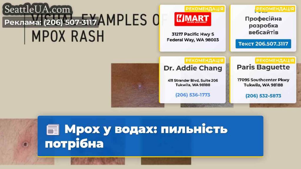 Mpox у водах: пильність потрібна