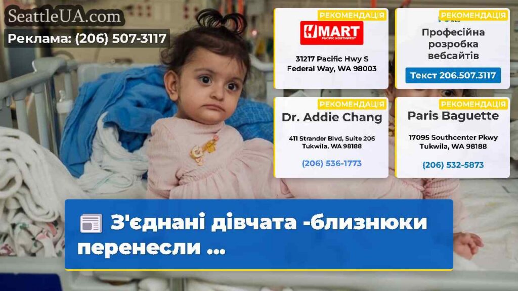 З'єднані дівчата -близнюки перенесли ...