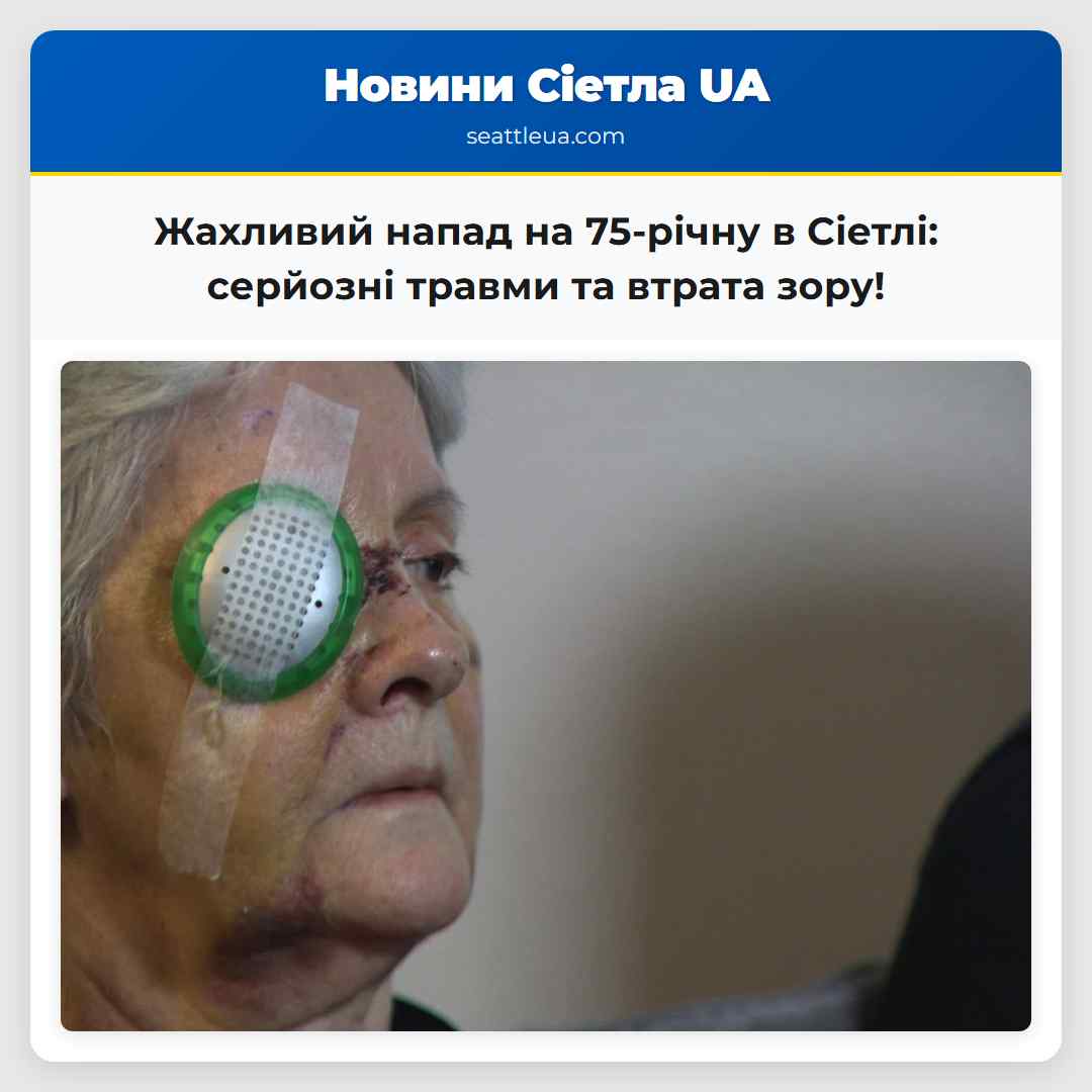 У Сіетлі жорстоко напали на 75-річну жінку залишивши її з серйозними травмами