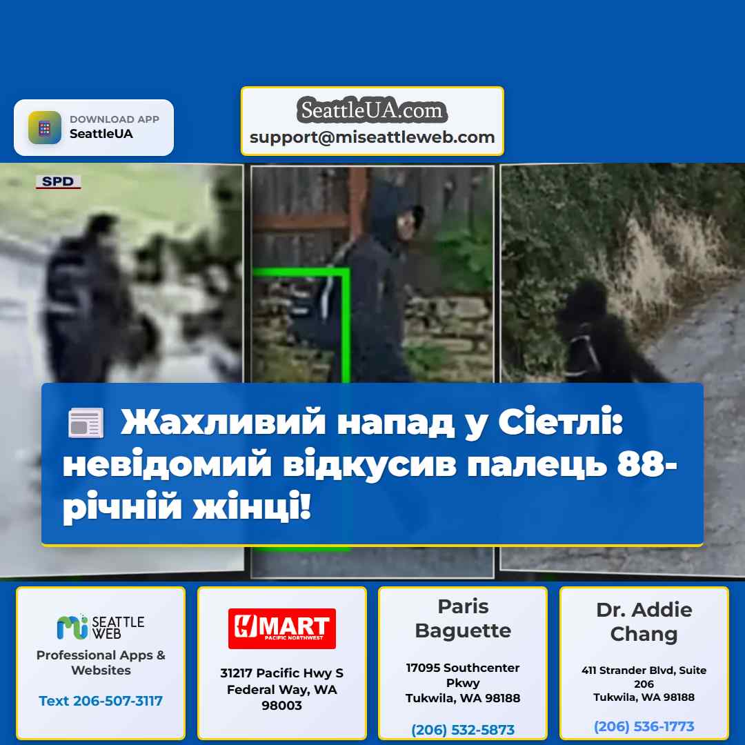Жахливий напад у Сіетлі: невідомий відкусив