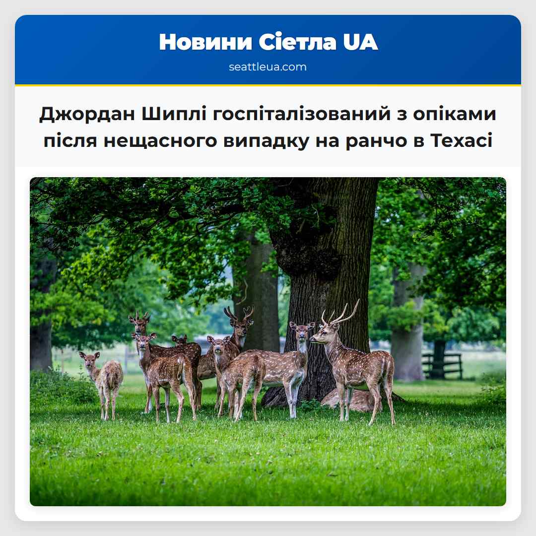 Джордан Шиплі госпіталізований з опіками після