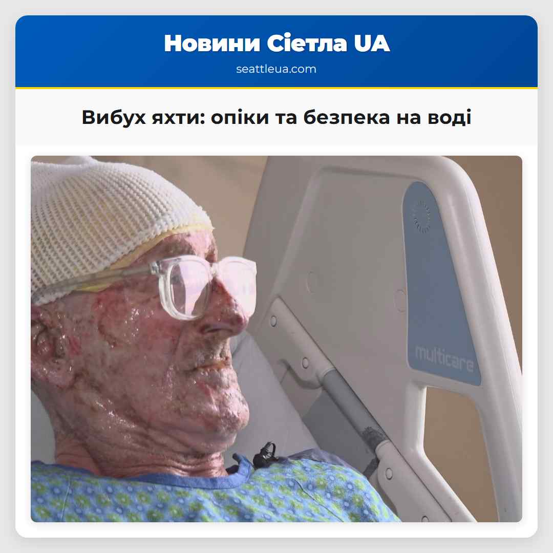 Вибух яхти: опіки та безпека на воді