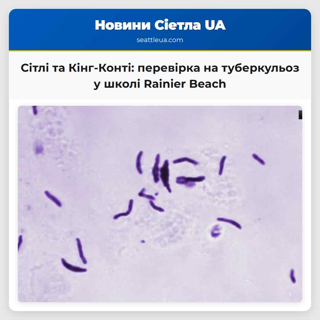 Сітлі та Кінг-Конті: перевірка на туберкульоз у