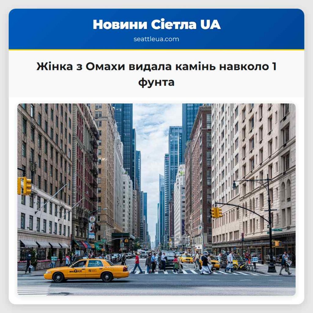 Жінка з Омахи видала камінь навколо 1 фунта