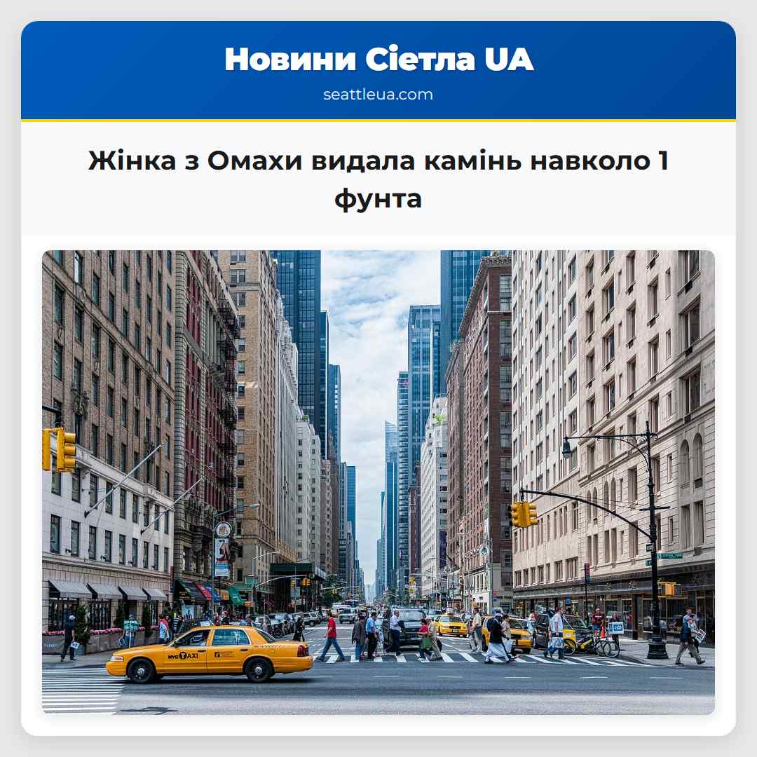 Жінка з Омахи видала камінь навколо 1 фунта