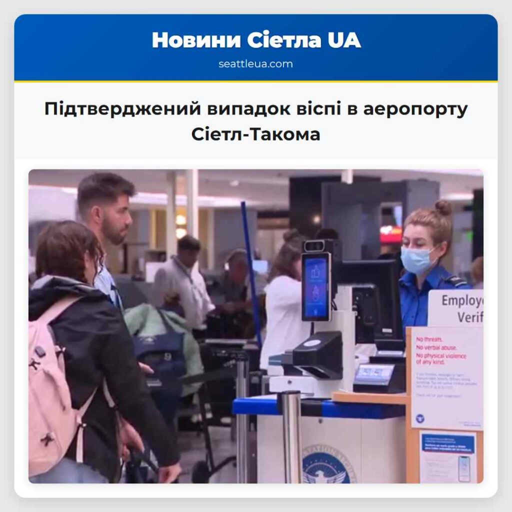 Підтверджений випадок віспі в аеропорту