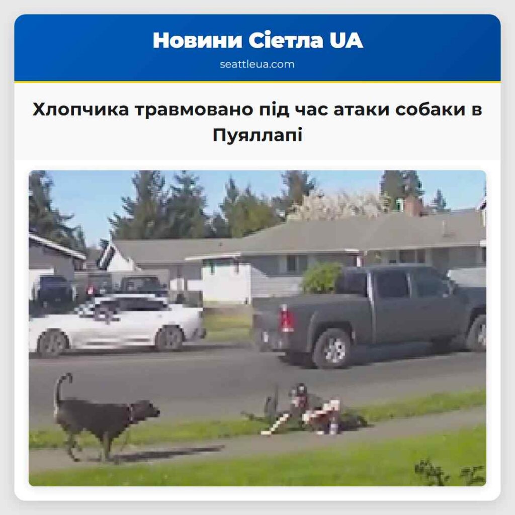 Хлопчика травмовано під час атаки собаки в
