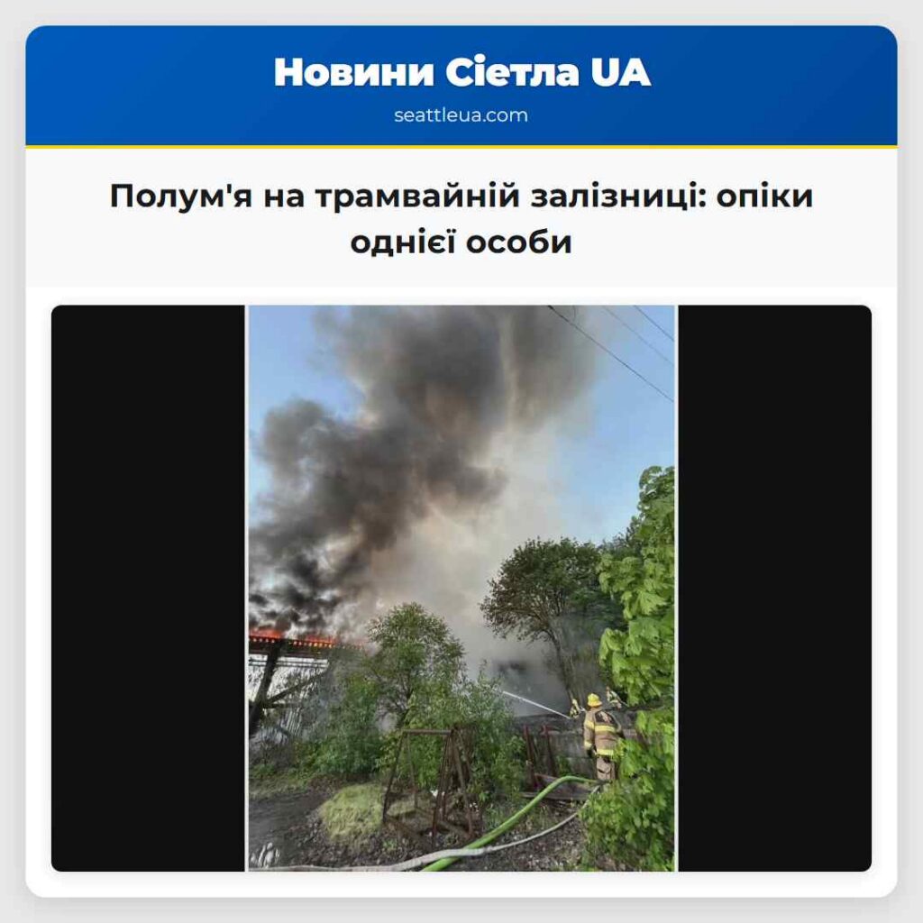 Полум'я на трамвайній залізниці: опіки однієї