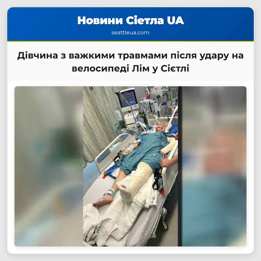 Дівчина з важкими травмами після удару на велосипеді Лім у Сієтлі
