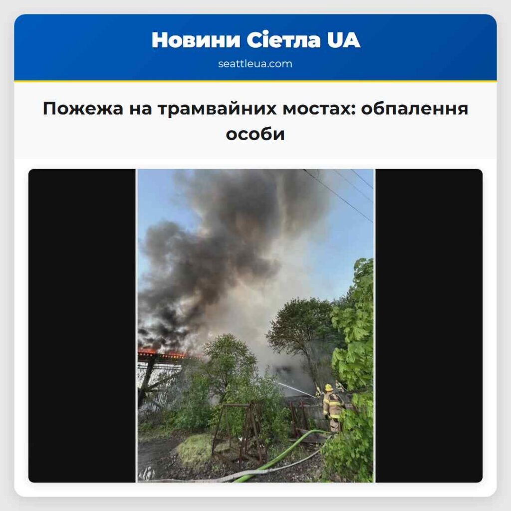Пожежа на трамвайних мостах: обпалення особи
