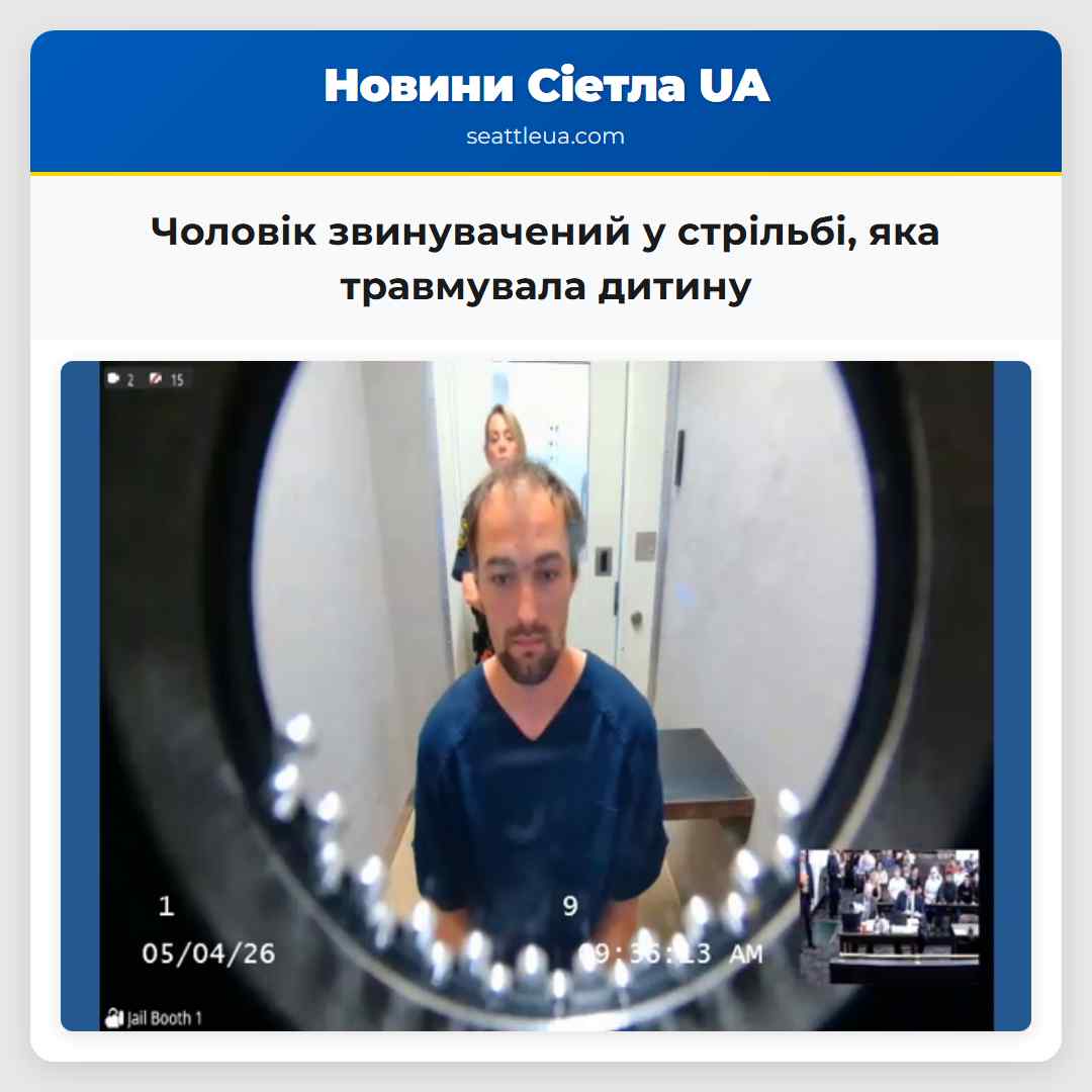 Чоловік звинувачений у стрільбі яка травмувала дитину
