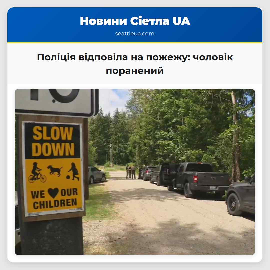 Поліція відповіла на пожежу: чоловік поранений